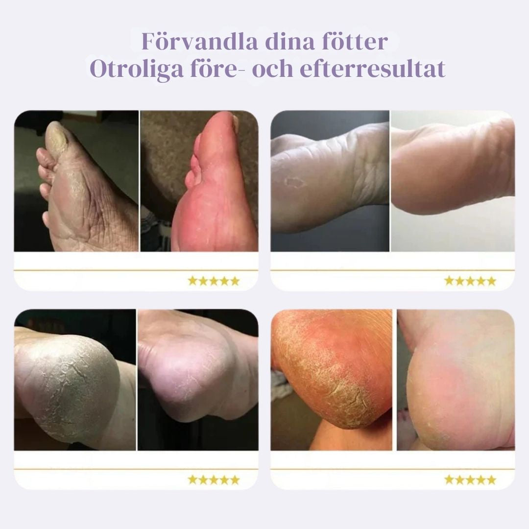 PediPro™ Elektrisk Fotfil